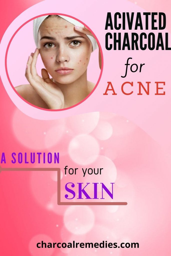 Acne Charcoal Remedies