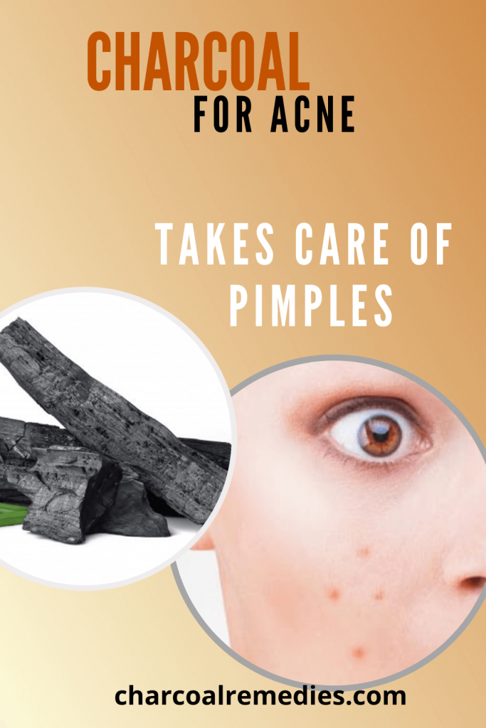 Acne Charcoal Remedies
