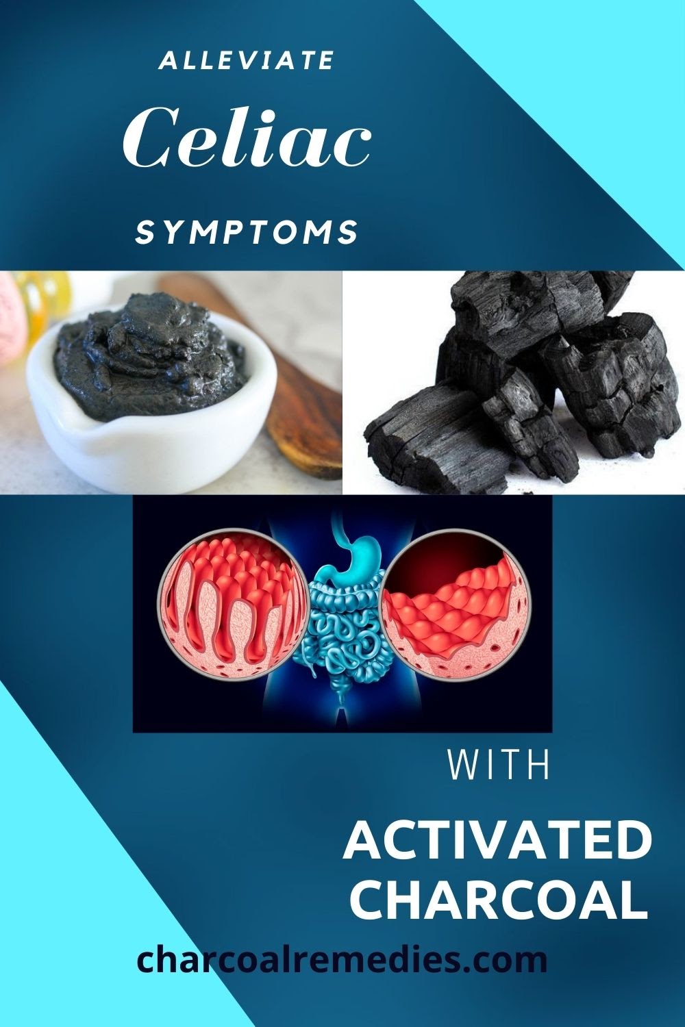 Alleviate Celiac Symptoms with Activated Charcoal Charcoal Remedies