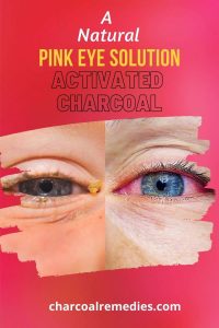 activated charcoal for pink eye 1