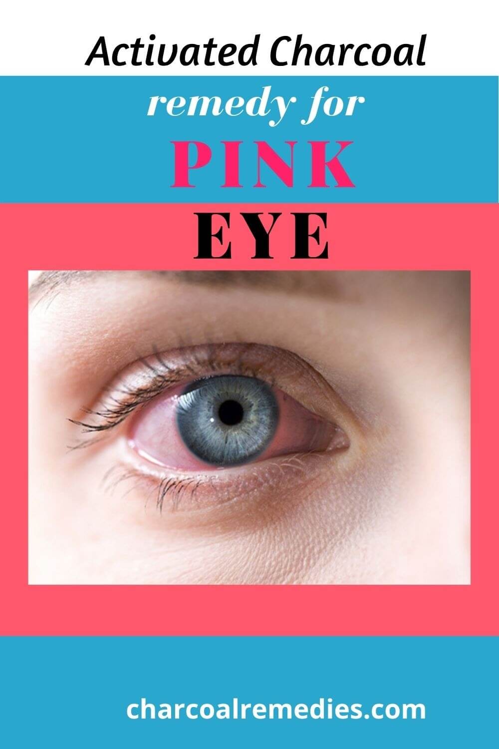 Pink Eye Charcoal Remedies