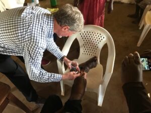 Applying Charcoal Directly to Wound