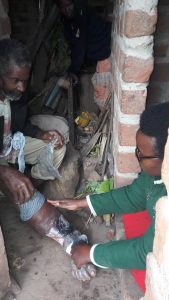 Medical Missionary Applying Charcoal Poultice