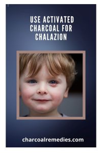 activated charcoal for chalazion treatment 2