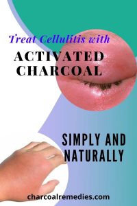activated charcoal for cellulitis 2