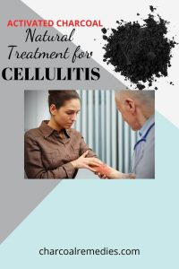 activated charcoal for cellulitis 4