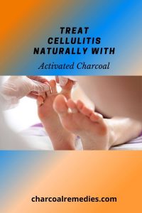 activated charcoal for celulitis 3